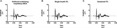 Reduced Phrenic Motoneuron Recruitment during Sustained Inspiratory Threshold Loading Compared to Single-Breath Loading: A Twitch Interpolation Study